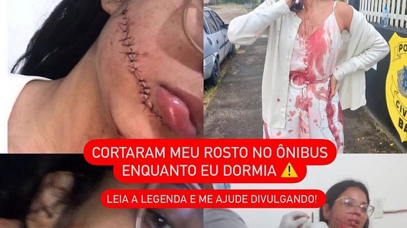 Mulher é esfaqueada no rosto enquanto dormia em viagem de ônibus para