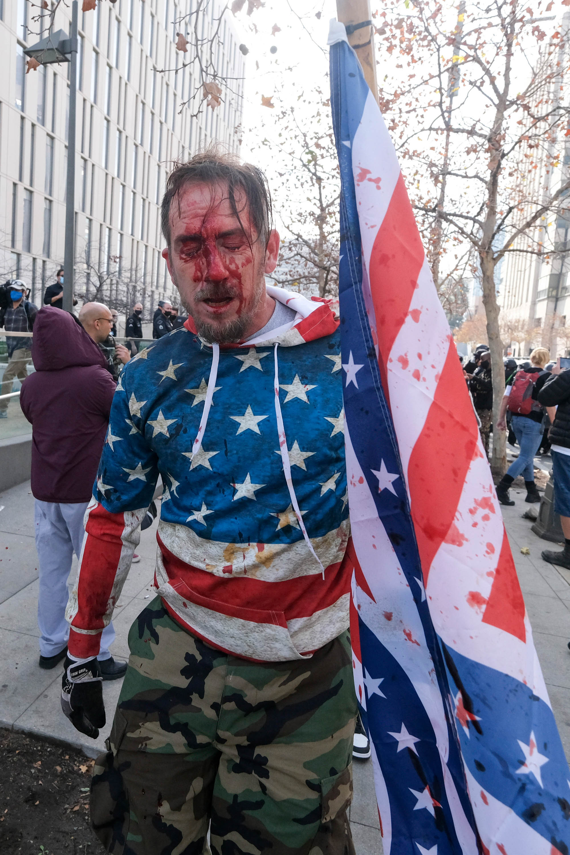 (Foto: RINGO CHIU / AFP)Um manifestante é visto coberto de sangue depois que uma briga estourou durante um protesto em apoio ao presidente dos EUA, Donald Trump, em Los Angeles em 6 de janeiro de 2021. - Os apoiadores de Trump, alimentados por suas alegações espúrias de fraude eleitoral, estão protestando contra a certificação esperada de Vitória de Joe Biden na Casa Branca pelo Congresso dos EUA em 6 de janeiro. (Foto: RINGO CHIU / AFP)