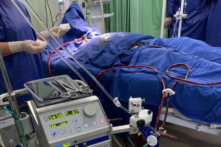 A ECMO já foi utilizada em pacientes da rede pública e privada em Fortaleza.