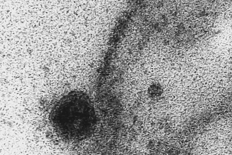 Início do processo de infecção pelo patógeno. Registro do momento exato em que uma célula é infectada pelo novo coronavírus, obtido durante estudo que investiga a replicação viral do Sars-CoV-2 realizado pelos Laboratório de Morfologia e Morfogênese Viral e Laboratório de Vírus Respiratórios e do Sarampo, Instituto Oswaldo Cruz.