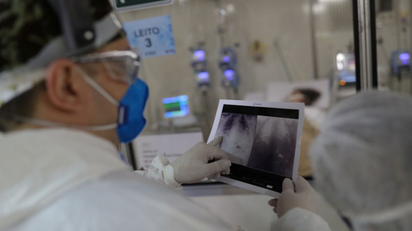 O médico examina uma radiografia de tórax de um paciente em um hospital em Guarulhos, São Paulo