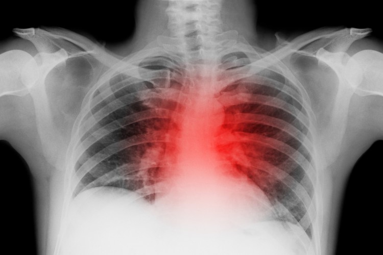 O menino tem um problema no coração e precisa da cirurgia cardiovascular, mas o procedimento está parado na Justiça