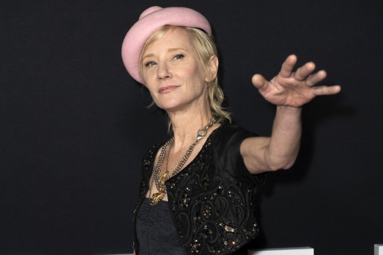 A atriz Anne Heche está na UTI após acidente de carro