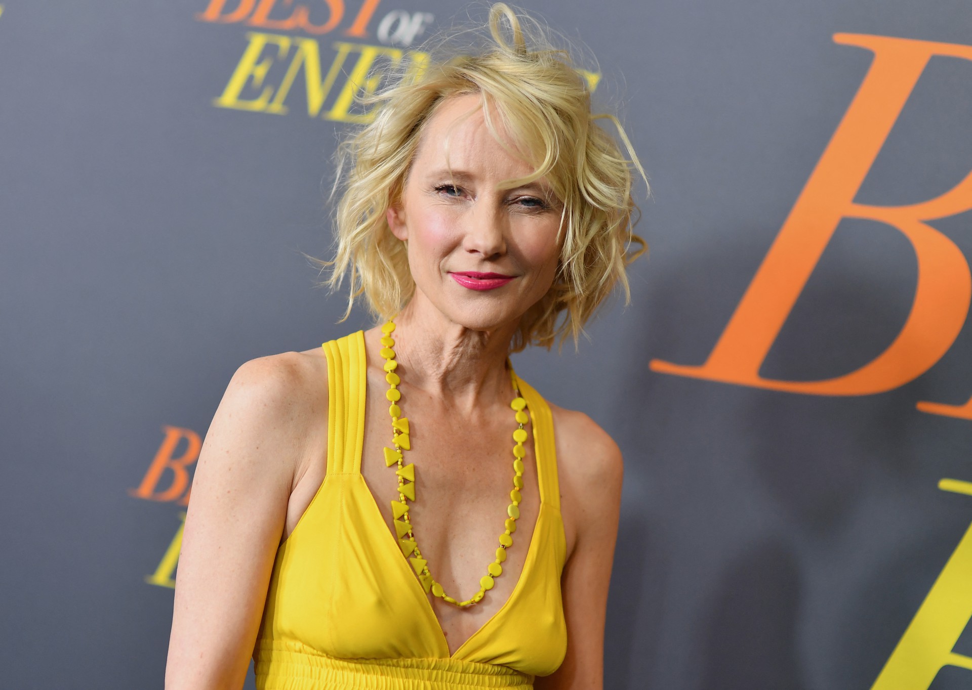 Anne Heche teve morte cerebral após acidente de carro (Foto: ANGELA WEISS / AFP)