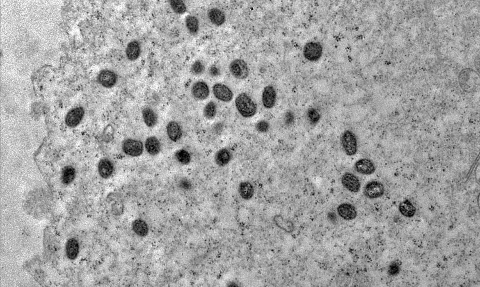 A MPOX pertence ao gênero orthopoxvirus (Foto: Fiocruz/divulgação)