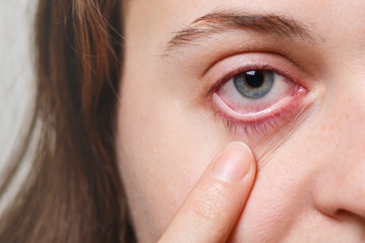 Foto de apoio ilustrativo. Especialistas recomendam cuidados com a saúde dos olhos durante as férias