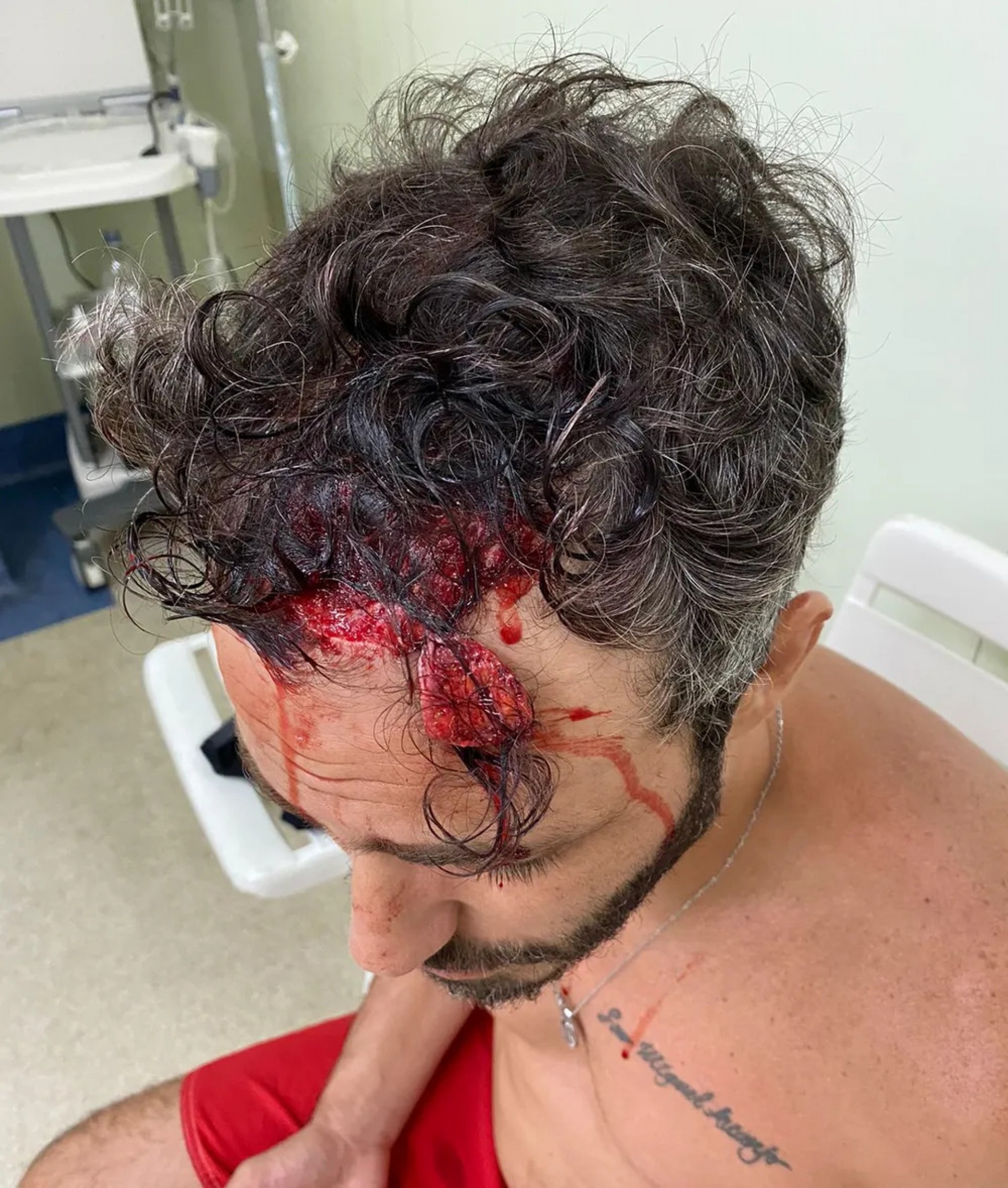 Thiago Rodrigues sofreu ferimentos na cabeça após ter sido espancado pelos assaltantes, na noite deste sábado, 10, e ficar desacordado