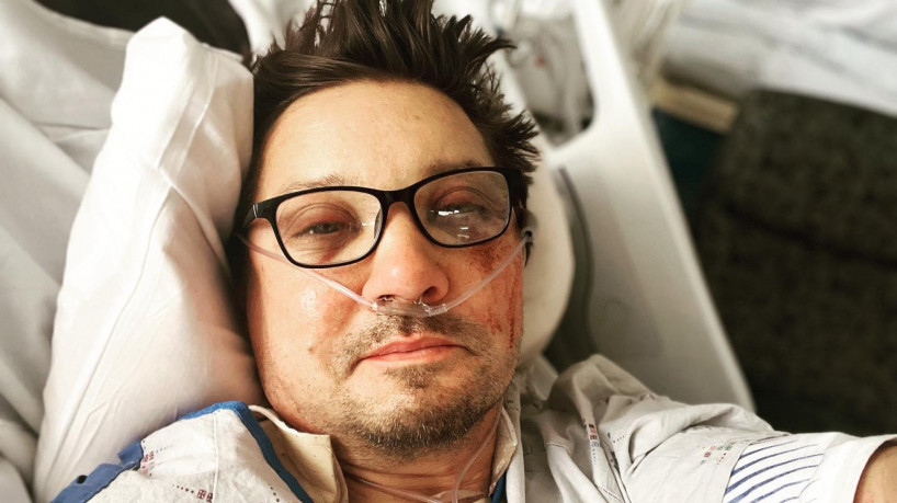 Jeremy Renner posta primeira foto após acidente