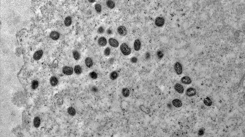 A varíola dos macacos é transmitida pelo vírus monkeypox, que pertence ao gênero orthopoxvirus