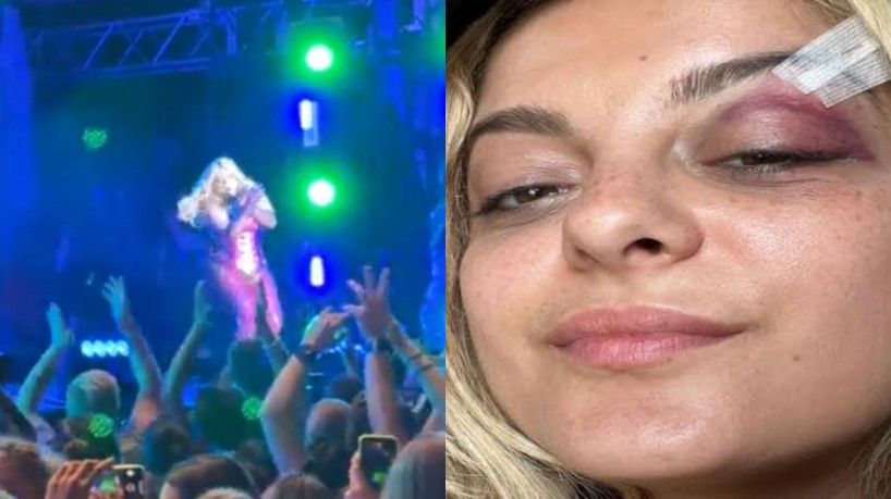 Bebe Rexha é atingifda por celular em show e mostra ferimento 