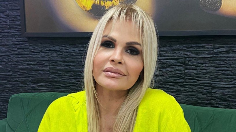 Monique Evans divulga antes e depois de harmonização facial