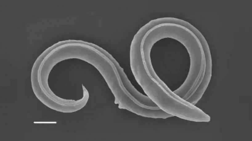 Os nematoides, que são uma tipo de verme, pertencem a uma nova espécie chamada de Panagrolaimus kolymaensis.

