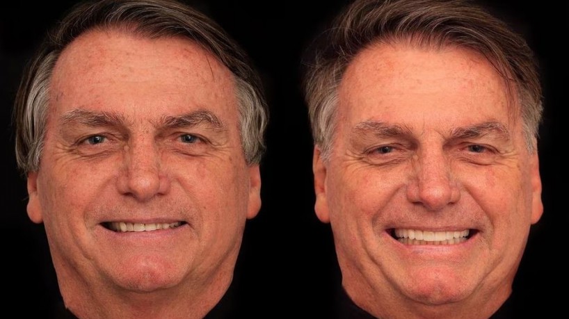 Jair Bolsonaro fez procedimento estético com dentista conhecido por celebridades