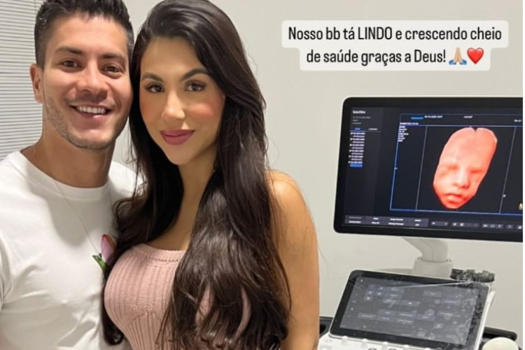 Arthur Aguiar e Jheny Santucci compartilham imagens do ultrassom do futuro filho