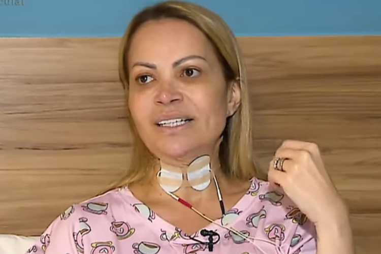 Solange Almeida revelou lesões em suas cordas vocais devido ao vício em cigarros eletrônicos