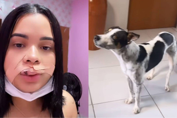 Eryka Costa foi mordida na boca pelo próprio cachorro após tentar beijar o animal. Modelo levou 10 pontos e deverá passar por uma reconstrução no lábio para recuperar o tecido no local