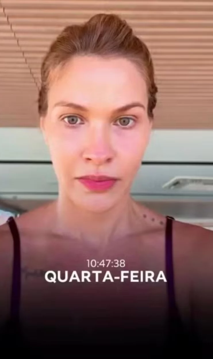 A modelo Andressa Suíça sofreu um acidente doméstico e publicou um alerta nas redes sociais contando o que aconteceu. Ela pediu que todos tenham atenção na manutenção do box no banheiro.