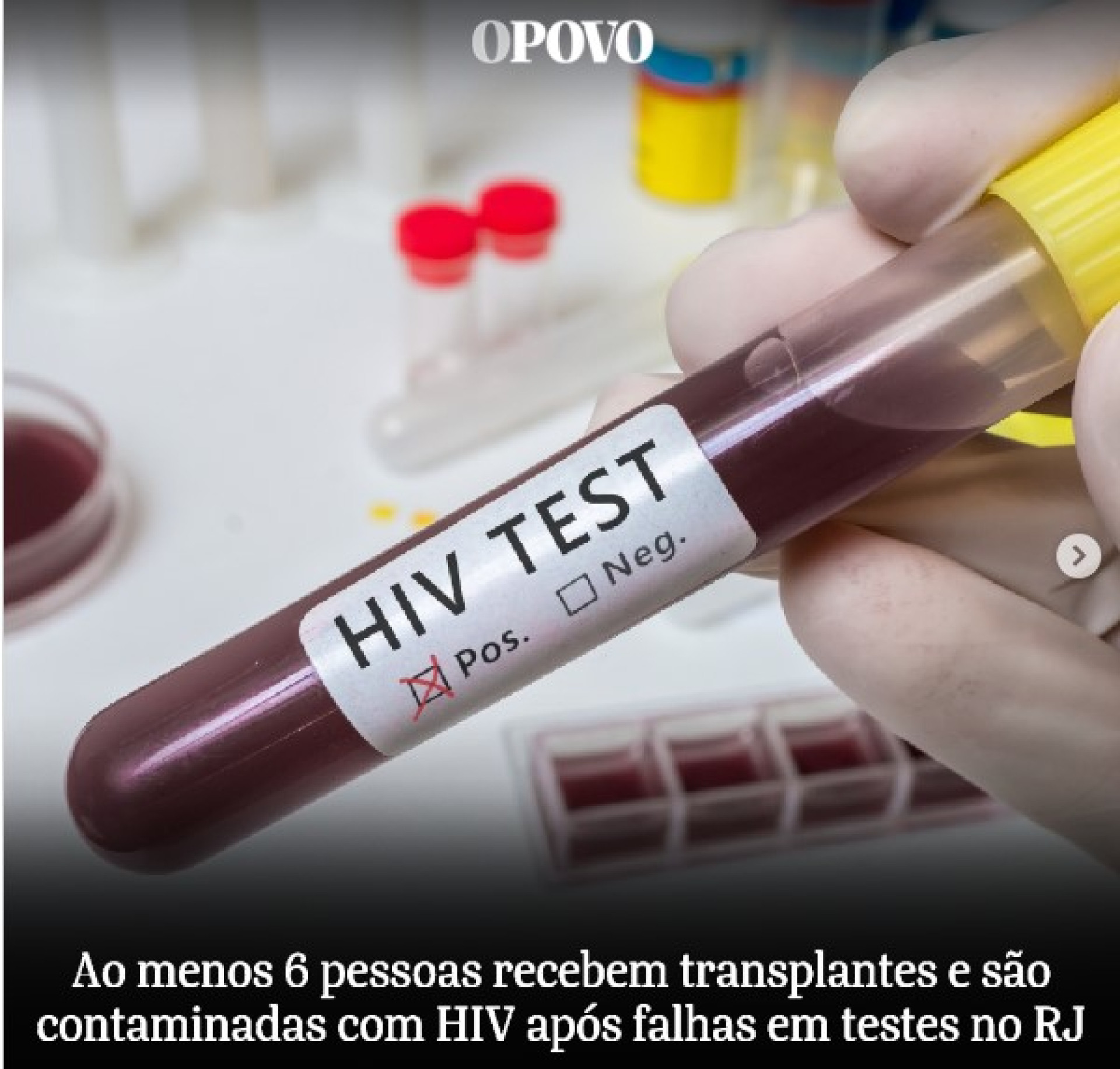 Título apresentou termo equivocado para falar sobre pessoas  infectadas pelo vírus HIV, no Rio de Janeiro (Foto: Reprodução)