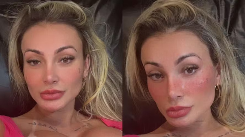 Andressa Urach faz tatuagem que simula sardas