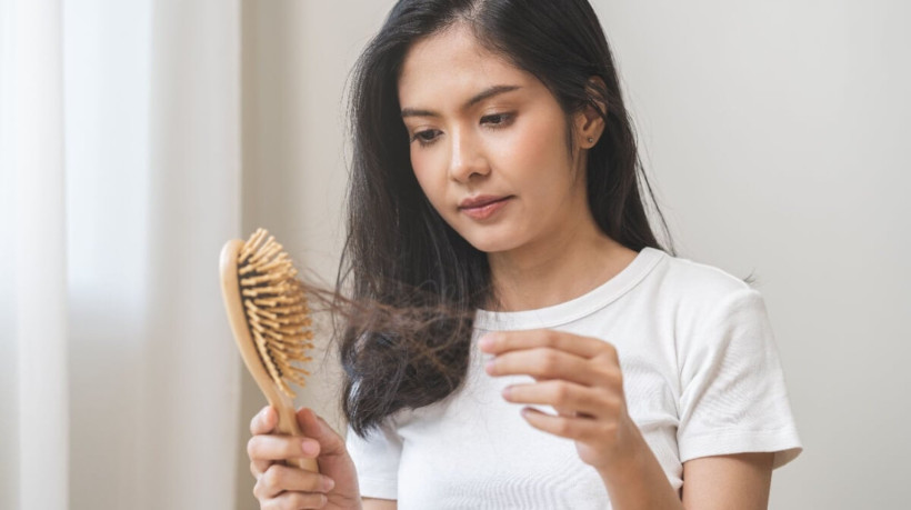 A queda de cabelo é um problema para muitas pessoas (Imagem: Kmpzzz | Shutterstock)