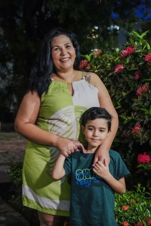 FORTALEZA-CE, BRASIL, 11-02-2025: Ciência e Saúde sobre as vivências do lupus. Na foto, Lana Nunes, portadora de lupus. (Foto: Fernanda Barros/ O Povo)(Foto: FERNANDA BARROS)