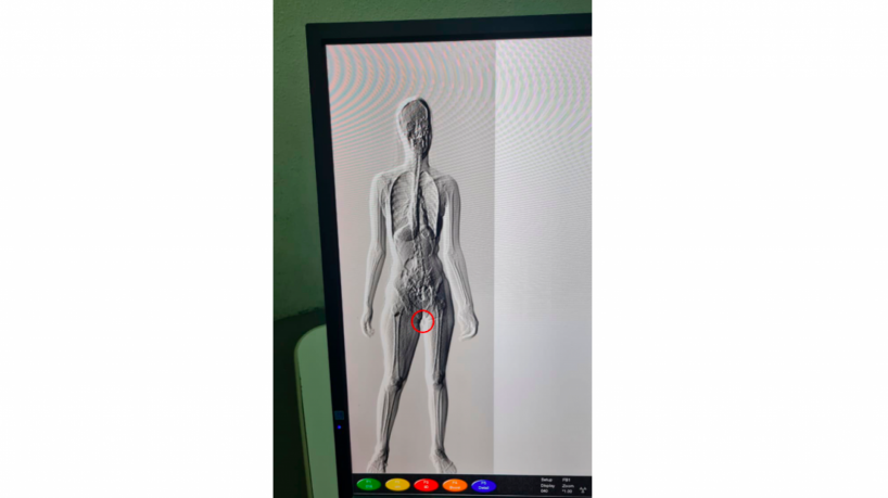 Body scanner apontou o local utilizado pela visitante para esconder a droga que entraria em presídio cearense