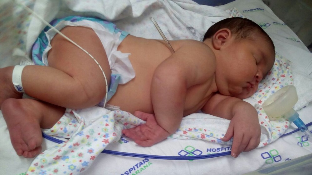 Com Quase 6 Kg Recem Nascida Vira Atracao Em Maternidade Do Oeste Do Parana Noticias Do Brasil